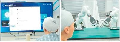 脑机接口新突破 中文失语患者有望重获“新声”